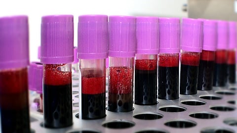 Blood samples 