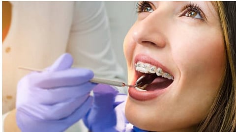 A patient with braces getting it checked in a dental clinic with a mouth mirror.
