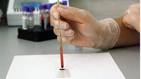 A patient is dropping some liquid sample on a glass slide.