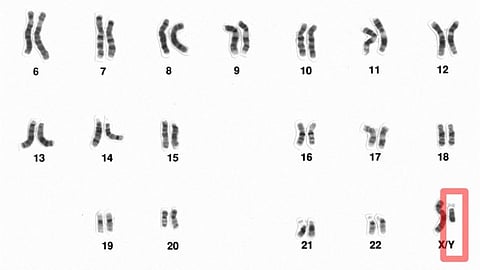 An image showing human male karyotype from 6 chromosomes to XY chromosomes.