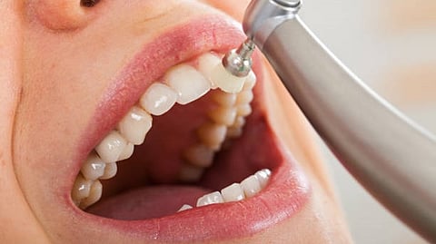 An oral cavity close- up picture.