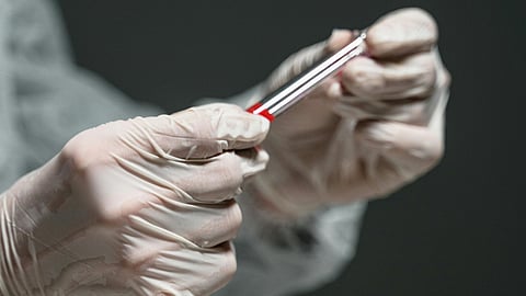 A man wearing gloves holds a red-labelled glass tube.