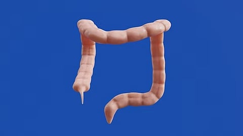 An image of an colon