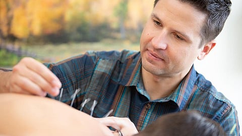 A man performing acupuncture on a patient