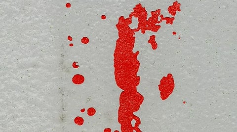 Red blood stains and streaks on a white wall, conveying a sense of chaos and urgency in the environment.