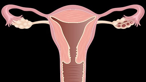 Illustration of the female reproductive system, showing the uterus, fallopian tubes, and ovaries.