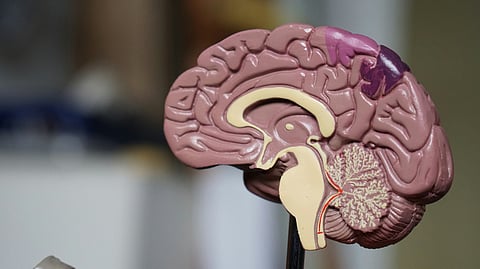 A model of sagittal section of human brain.