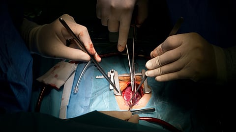 Surgeons performing organ transplant.