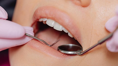 A close-up image of an oral cavity during a dental examination.