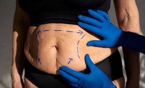 The image shows a doctor examining an obese women.