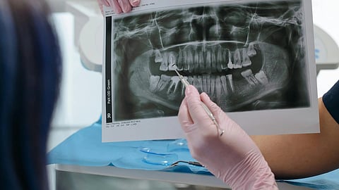 Doctor showing OPG x ray report to a patient.