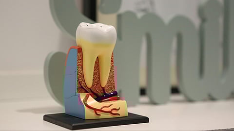 A cross-sectional model of a tooth.  