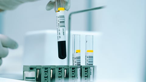 A person in a lab coat holds a test tube, focused on their work in a laboratory setting.