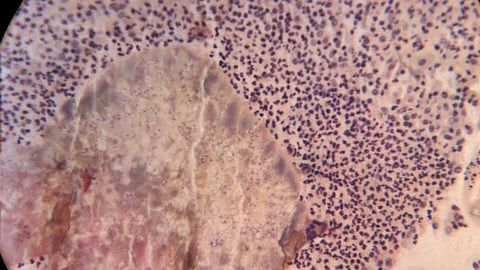 Graphical illustration of white blood cells.