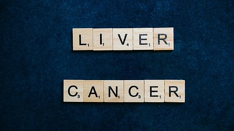 Scrabble tiles arranged to spell 'LIVER CANCER', placed on a dark blue textured background.