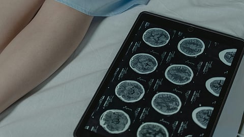 A scan report showing brain tumor in different angles in a tab