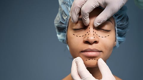 Image of a woman getting markings for a rhinoplasty done.