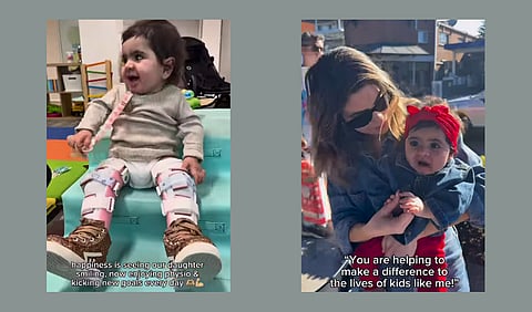 Sydney Toddler with HFS 