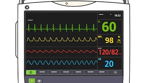 A medical monitor screen with a black background displaying a patient's vital signs. The screen shows an electrocardiogram.