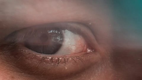 A close-up blurry image of an eye.