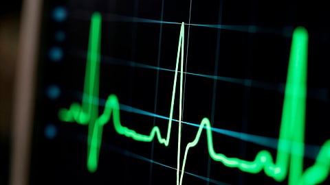 A heart beat in ECG monitor.