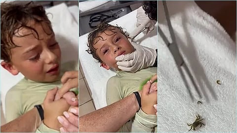 An illustration of a doctor removing a crab from a boy. 