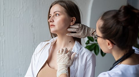  A female doctor in gloves examines a female patient for melanoma diagnosis.