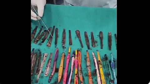 A surgery cloth on which all the removed brushes and spoons kept after surgery.