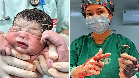 A baby holding the IUD