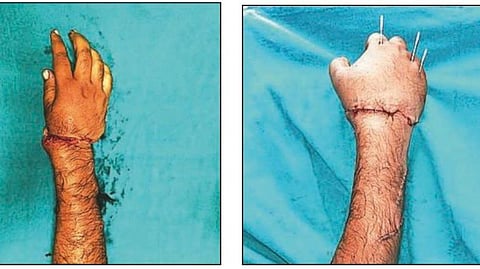 The attack took place on September 17, 2025, in the Sadar police station area of Barmer. 