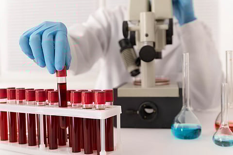 blood samples arrangement in lab