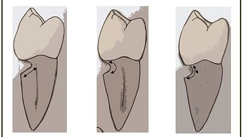 Image showing deformities in the teeth.