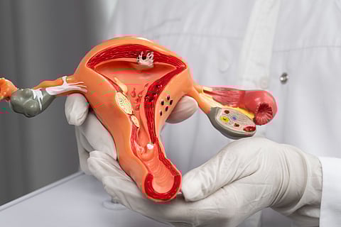 Doctor holding anatomic model high angle