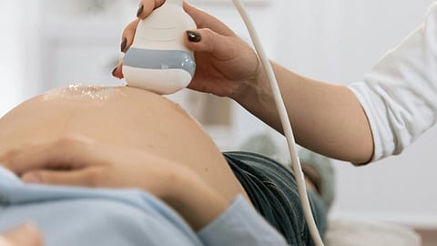 An image of a woman getting ultrasound.