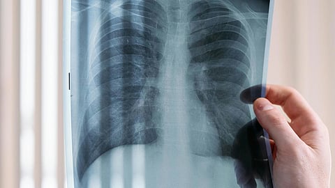 A person holds a tablet displaying an X-ray image, showcasing a detailed view of bones or internal structures.
