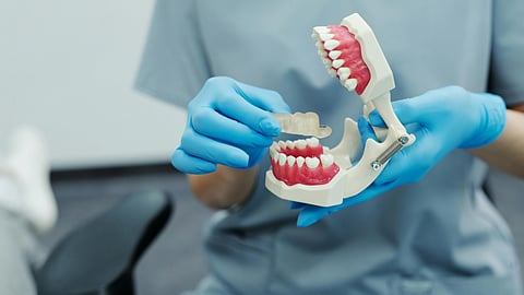 An image of a teeth model in hands of a dentist.