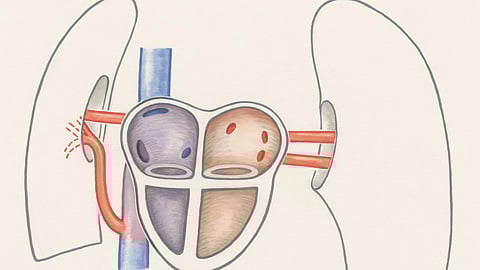 A drawing of a heart with a tube extending from its side, symbolizing connection or circulation.