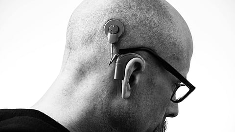 Image of a bald person wearing cochlear implants.