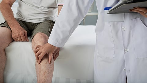An image of a doctor checking a person's leg vein.