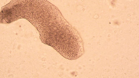 Image of Amoeba under a microscope.