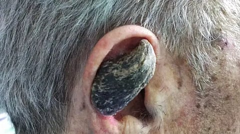 An image of a man holds a shell piece to his ear, resembling a horn.