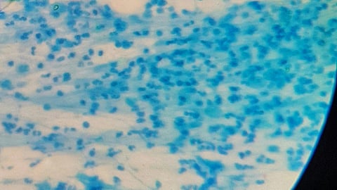 Image of microbes under the microscope.