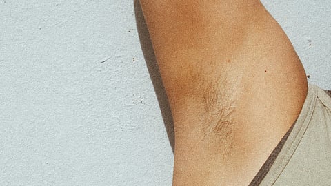 An image of underarms.
