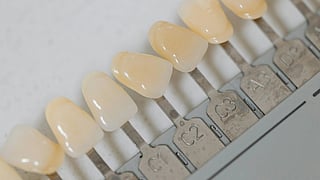 Image of dental implants on a strip.