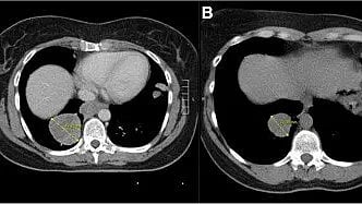 Two identical MRI scans displaying the same area for comparison and analysis.
