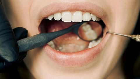 An image of a person's mouth open with a dental tool.