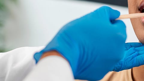 Image of a person doing saliva test on a patient.