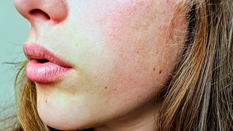 A close-up of a woman's face showcasing her freckles and natural beauty.
