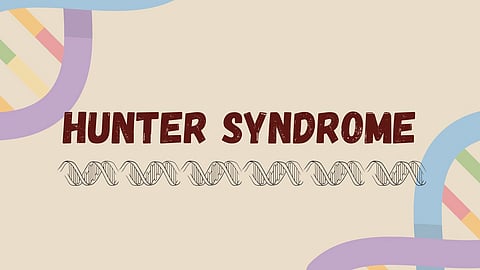 Image showing hunter syndrome.
