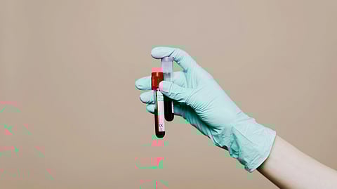 A gloved hand holds a blood sample in a test tube against a neutral background.